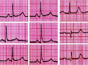 知世界医学脉搏,助力中国临床决策: 疾病诊疗知