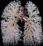 结缔组织病相关的间质性肺病(CTD-ILD)基础知