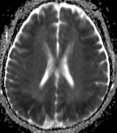 什么是黑色素瘤病 1604634875265214.jpg