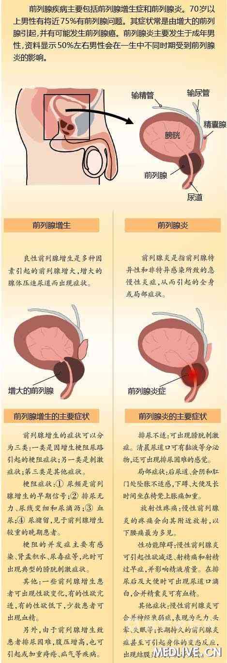 湘雅医院 中西医结合科 张春虎 &nbsp; &nbsp; 前列腺疾病是影响男性