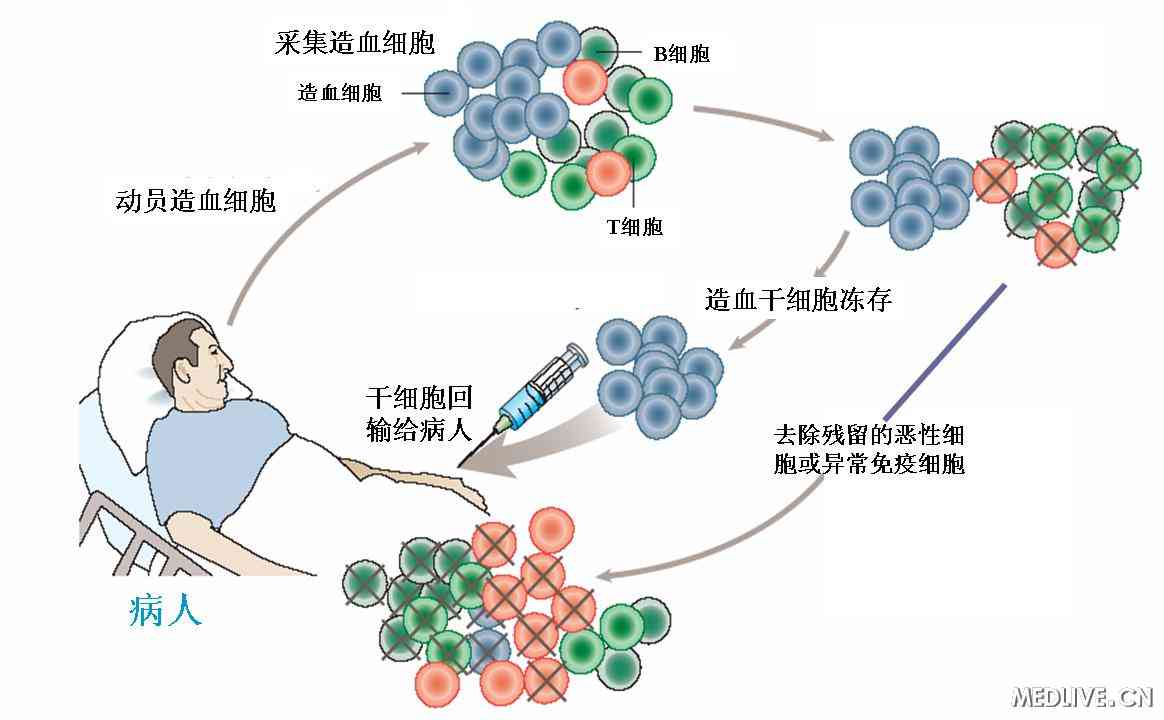 造血幹細胞移植原理簡圖