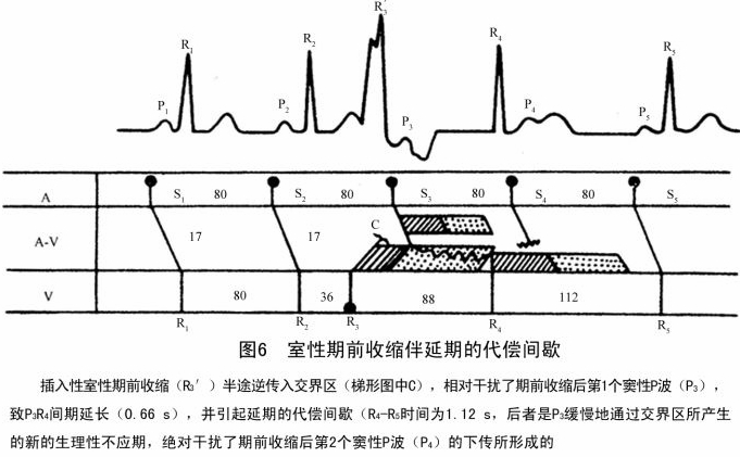 类代偿间歇