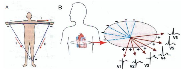 至此,记录心电图的标准12导联系统全部推出:3个双极肢体导联(Ⅰ,Ⅱ,Ⅲ