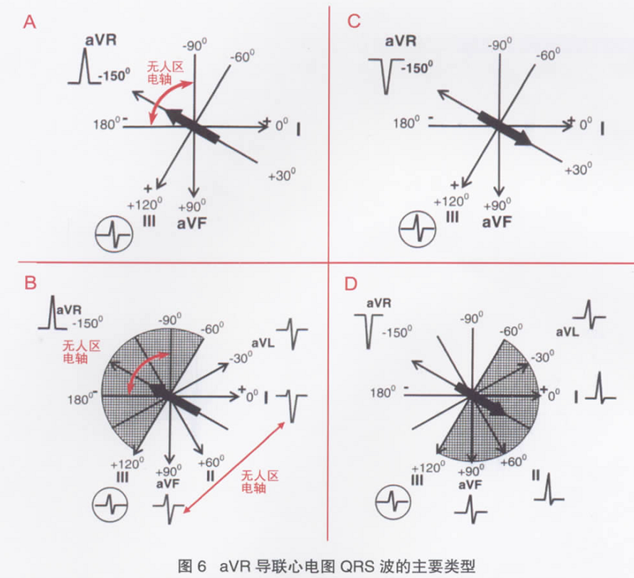 顺时针旋转心电图图片