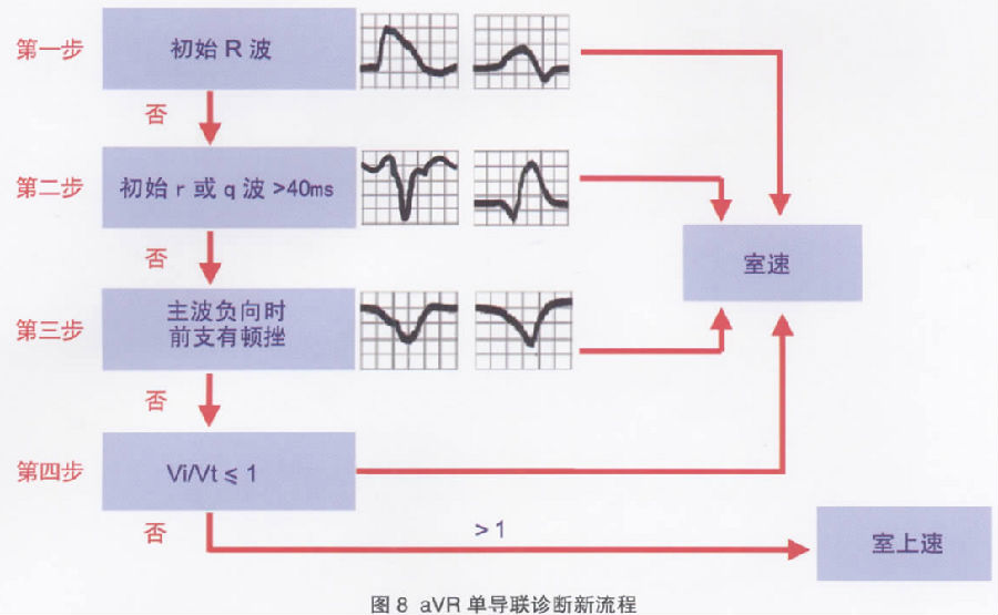 郭继鸿:宽qrs波心动过速鉴别诊断新流程(上)