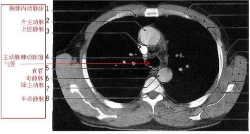 胸壁肌肉CT图片