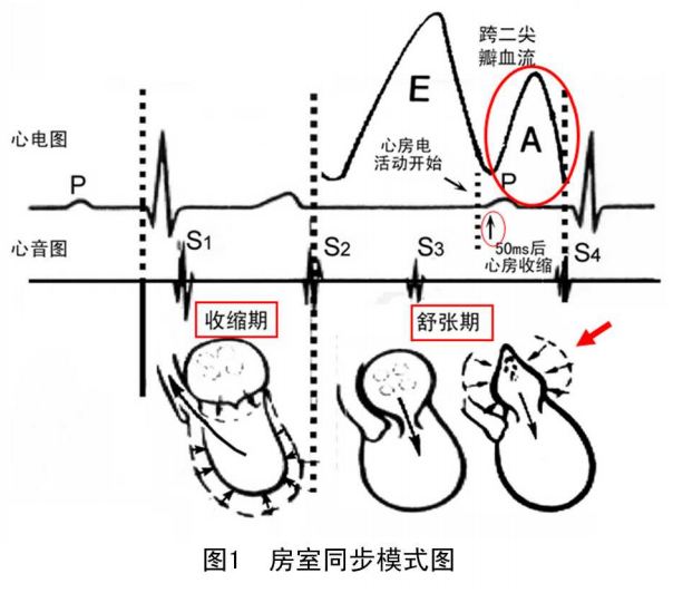 郭继鸿:图解房室同步 心血管内科讨论版 爱爱