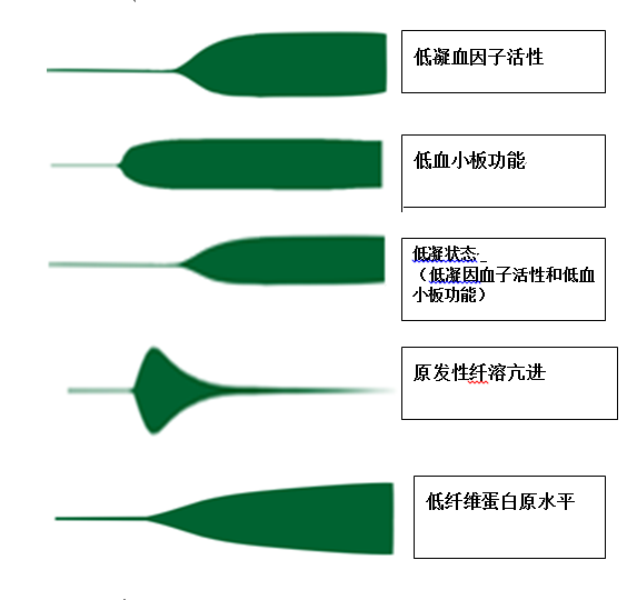 血栓弹力图高凝状态图片