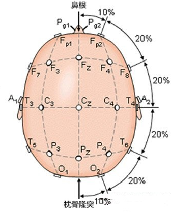 实战图形教你掌握正常成人脑电图