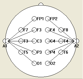 脑电图的定位方法图片