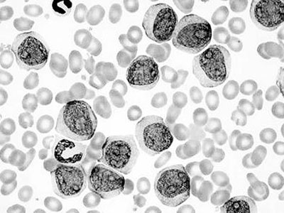 染色质基因分析可识别癌症起源