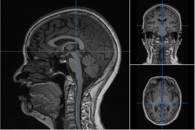 六步十图认识下丘脑