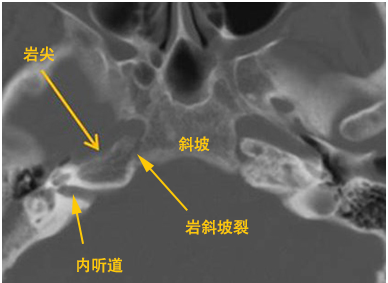 外展神经的探险旅行