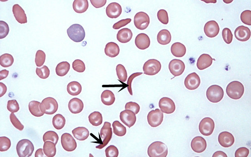 口形红细胞图片图片
