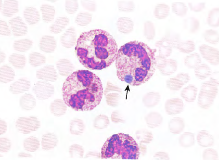 快速掌握│粒细胞正常与异常形态
