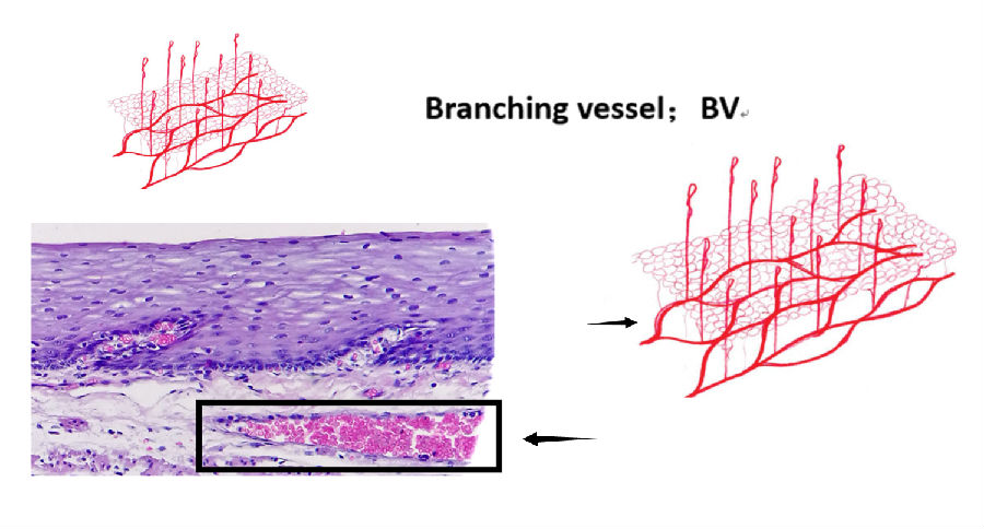 毛细血管壁分层结构图图片