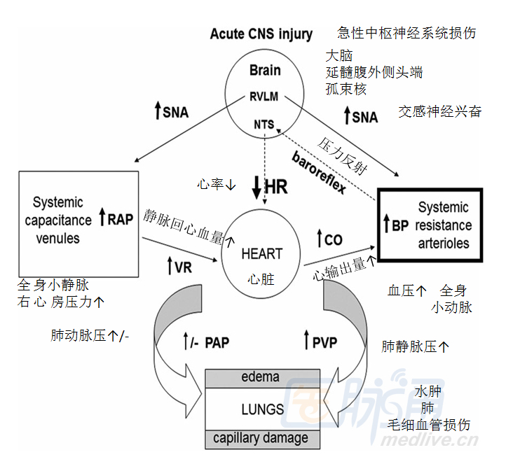 acute pulmonary edema图片