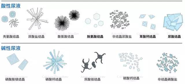 尿沉渣是什么意思图片