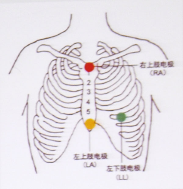 三导联位置图片图片