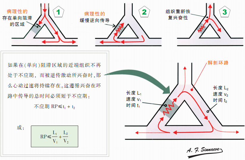 在解剖环路中折返性心动过速发生的必备条件