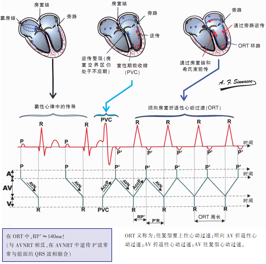 图文并茂快速性心律失常是怎样发生的