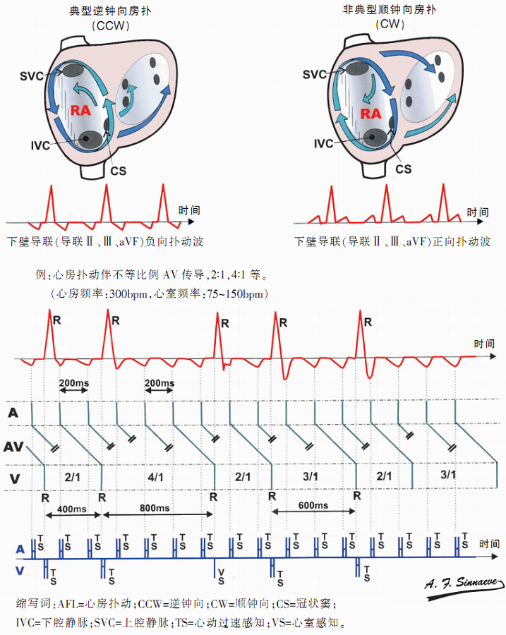 顺钟向房扑图片