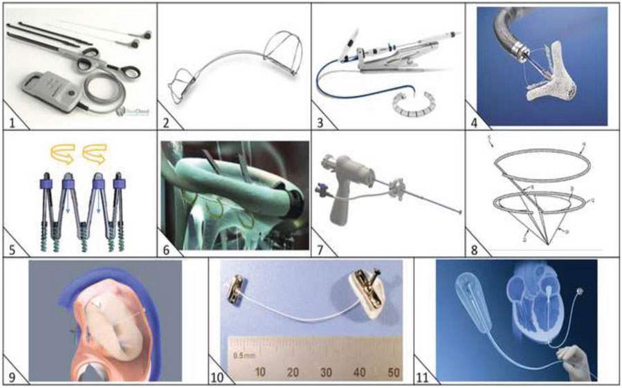 经导管心脏瓣膜介入治疗:我们将何去何从?