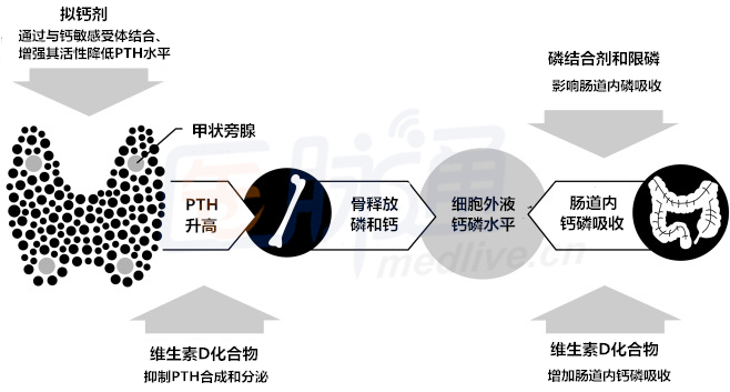 血透患者繼發性甲旁亢如何治療?