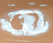 第二十二届长城国际心脏病学会议暨亚太心脏大会2011