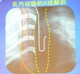 第二十二届长城国际心脏病学会议暨亚太心脏大会2011