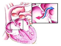 第22届欧洲卒中大会