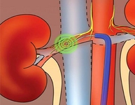 2013年中国高血压年会及第15届国际高血压及相关疾病学术研讨会