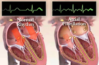 2014年美国心脏病学会年会（ACC2014）