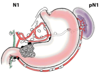 2014年消化疾病周(DDW)