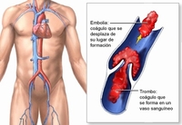 第十三届中国介入心脏病学大会（CIT2015）