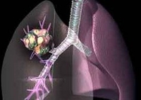 2014美国临床肿瘤学会(ASCO)年会