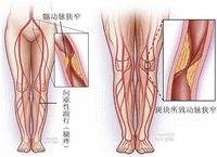 第十三届中国介入心脏病学大会（CIT2015）