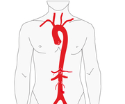 2014欧洲心脏病学会年会（ESC2014）