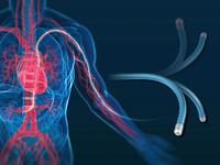 第十三届中国介入心脏病学大会（CIT2015）