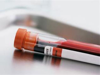 第二十五届长城国际心脏病学会议（GWICC2014）