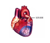 第十三届中国介入心脏病学大会（CIT2015）