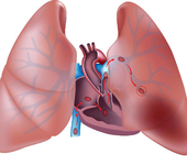 2015美国心血管造影和介入学会科学年会（SCAI2015）