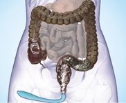 2015年消化道疾病周（DDW）