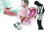 第十八届全国临床肿瘤学大会暨2015年CSCO学术年会