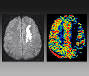 第十二届国际脑血管病高峰论坛