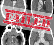 2016年国际卒中大会（ISC2016）