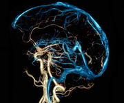 2016年国际卒中大会（ISC2016）