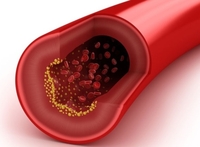 2016美国国家脂质协会科学年会（NLA2016）