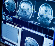 2016年美国神经病学会年会（AAN2016）