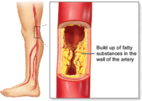 2017年美国心脏病学会年会（ACC2017）